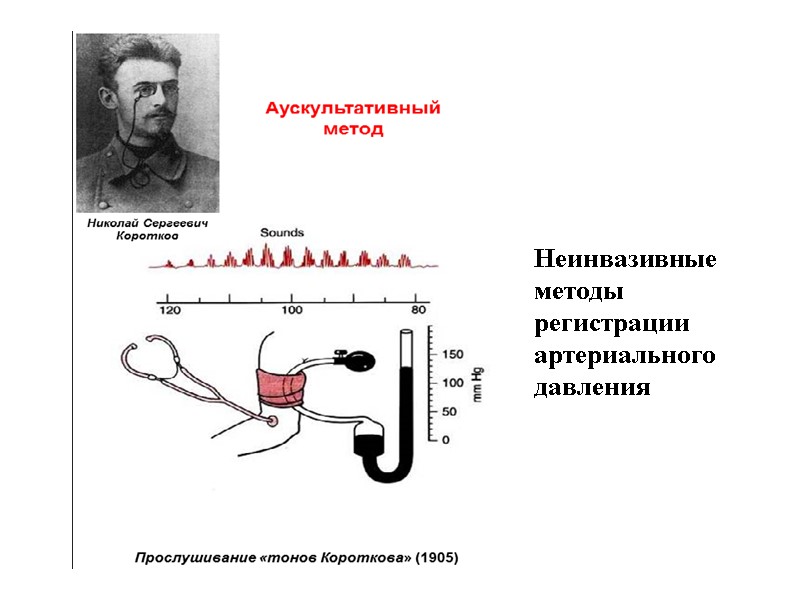 Неинвазивные методы регистрации артериального давления
